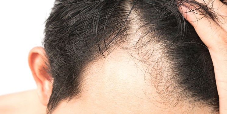 طرح جابر موی بدن و نقش آن در تعدیل دمای بدن